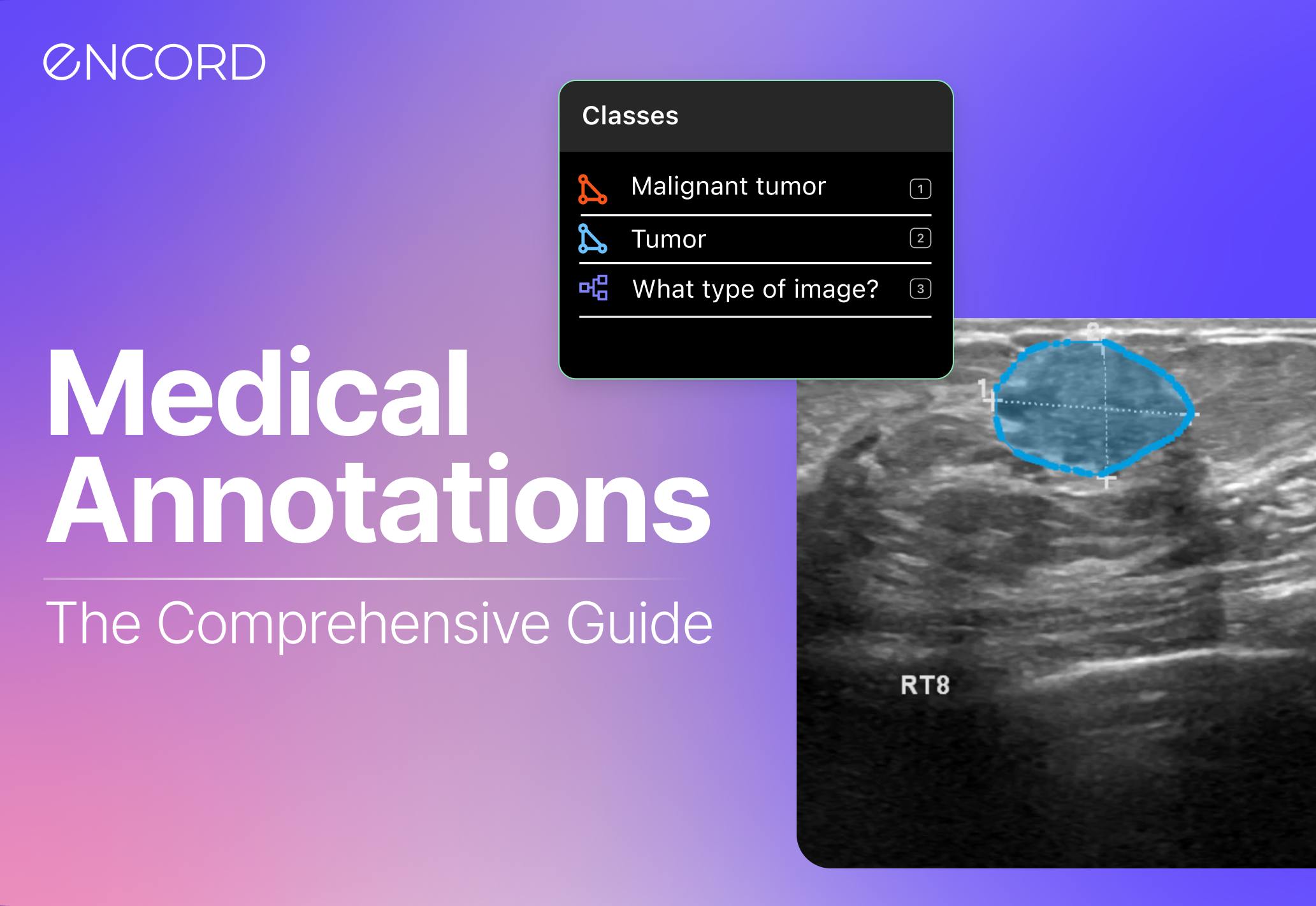 Complete Guide to Medical Image Annotations | Encord
